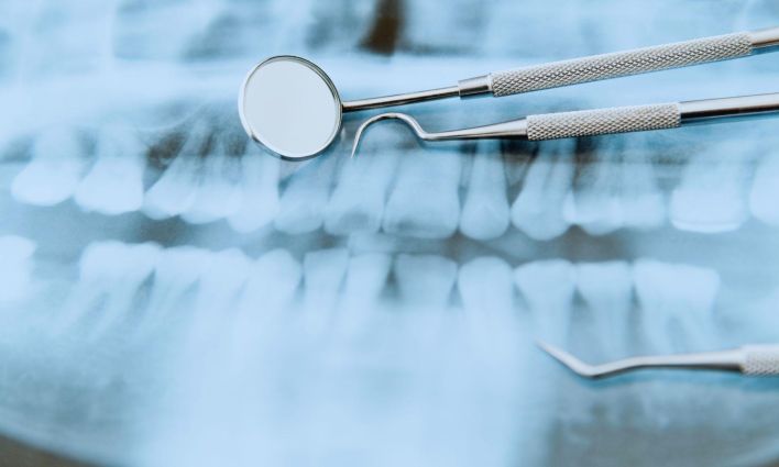 The Canadian Dental Care Plan will have higher copayments than expected